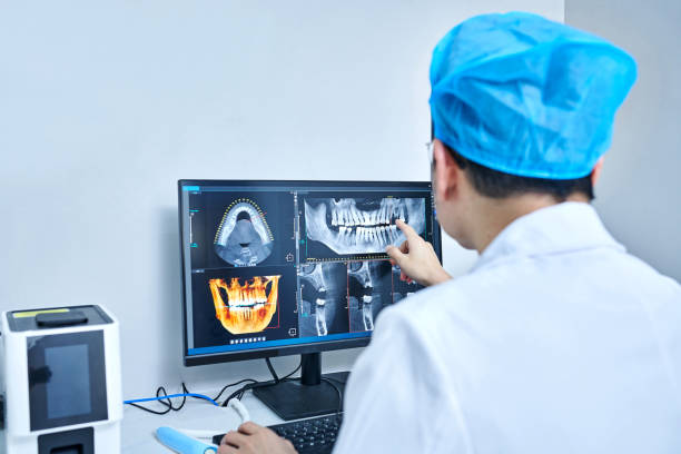Best Emergency Wisdom Teeth Removal in Squaw Valley, CA